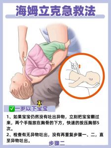 海姆立克法